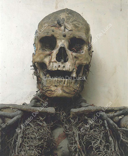 Reconstruction of the circulatory system. Skull